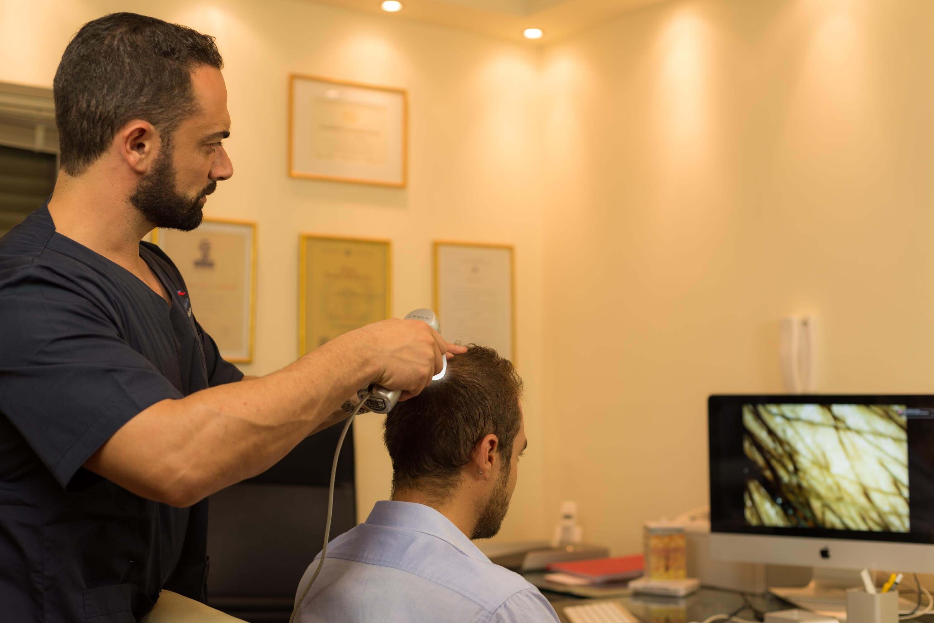 Μεταμόσχευση Μαλλιών στο Vertex Anastasakis Hair Clinic