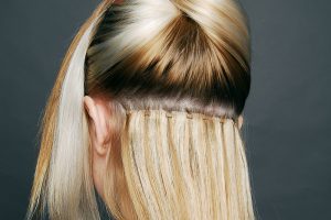 τριχόπτωση και μεταμόσχευση μαλλιών στις γυναίκες