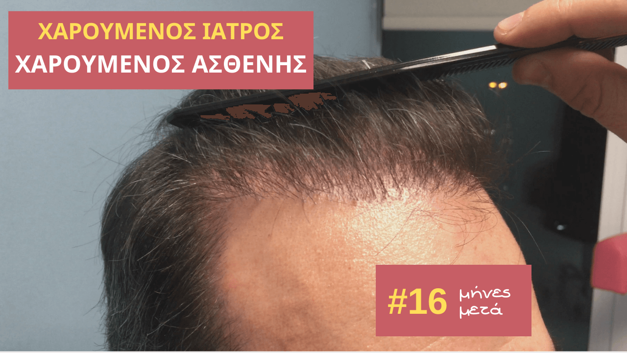 χαρουμενος ιατρος, χαρουμενος ασθενης 16 μηνες μετα