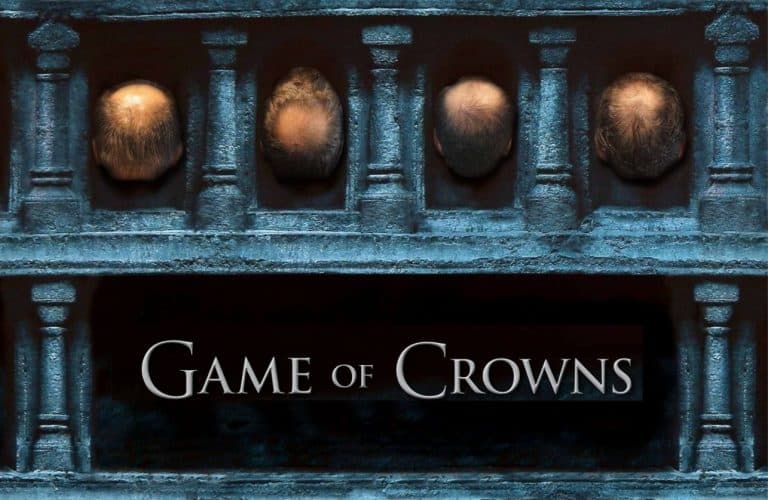 Game of Crowns: Η Αραίωση στην κορυφή