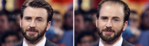Celebrities χωρίς μαλλιά: Chris Evans