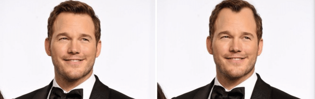 Celebrities χωρίς μαλλιά - Chris Pratt
