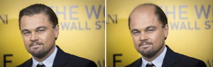 Η τριχόπτωση στο Leonardo Di Caprio