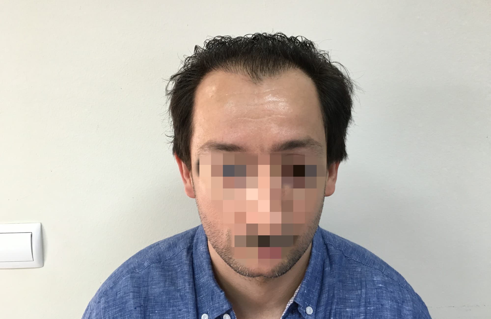 Αποτέλεσμα με 2500 FUs