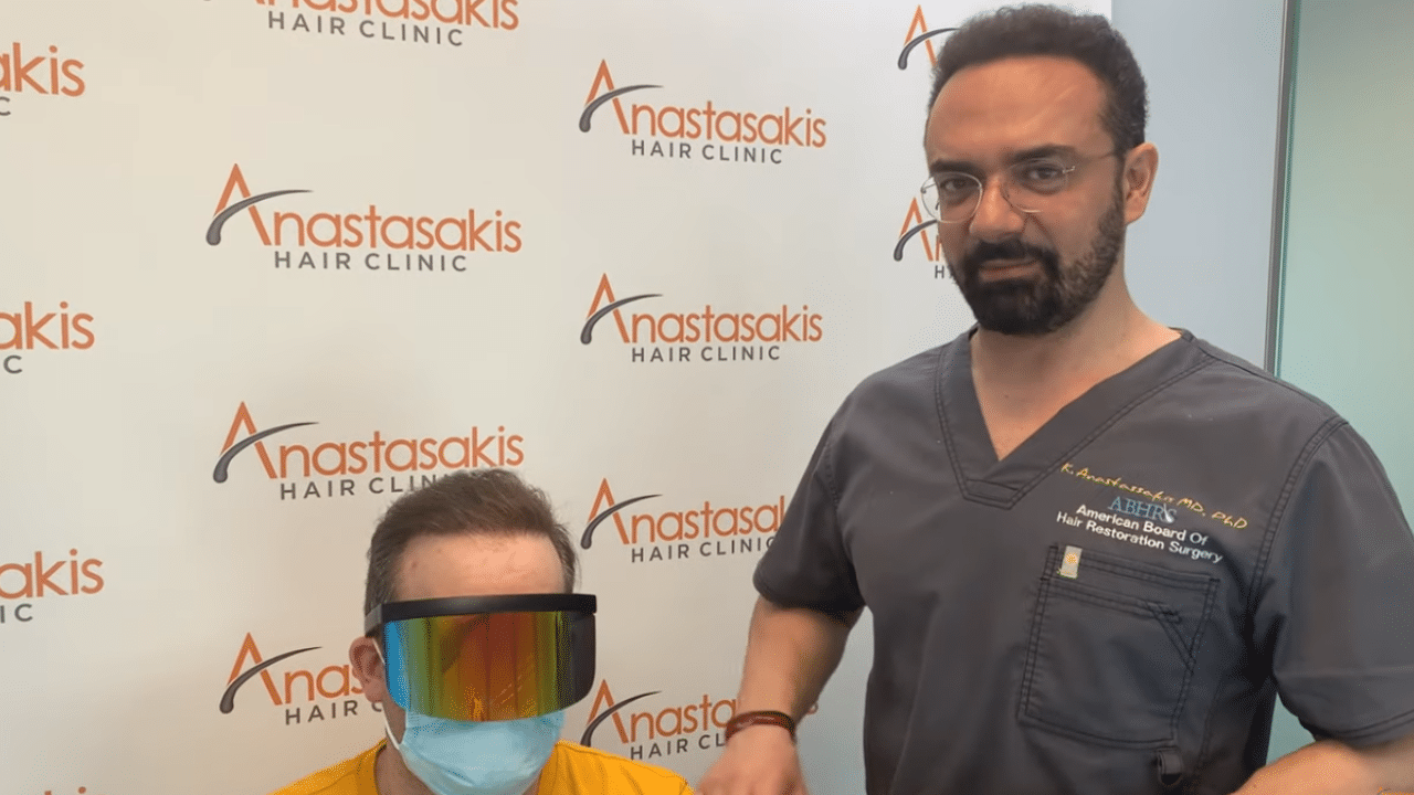 3200 τριχοθυλακια - αποτελεσμα της anastasakis hair clinic