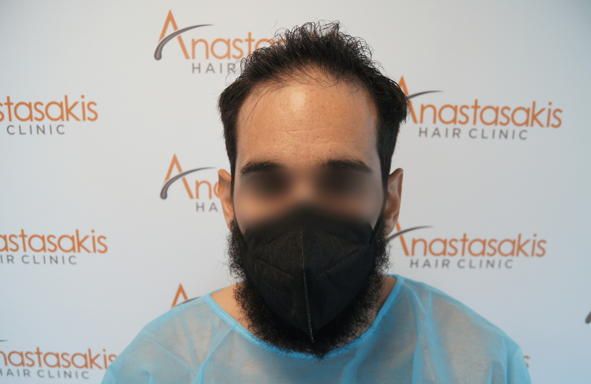 Αποτέλεσμα με 2100 FUs