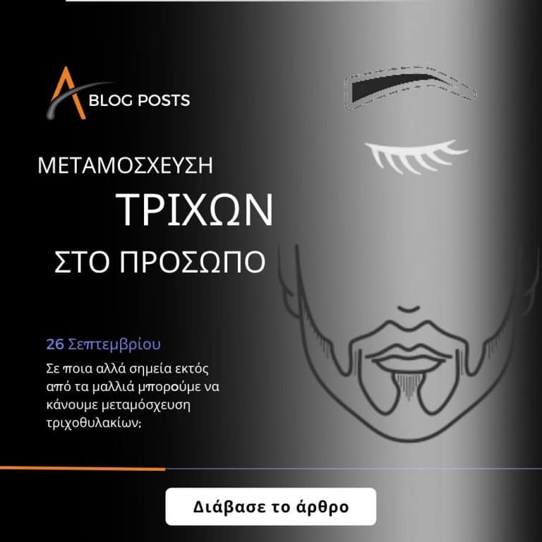 Μεταμόσχευση τριχών στο πρόσωπο: Σε ποια αλλά σημεία εκτός από τα μαλλιά μπορώ να κάνω εμφύτευση;