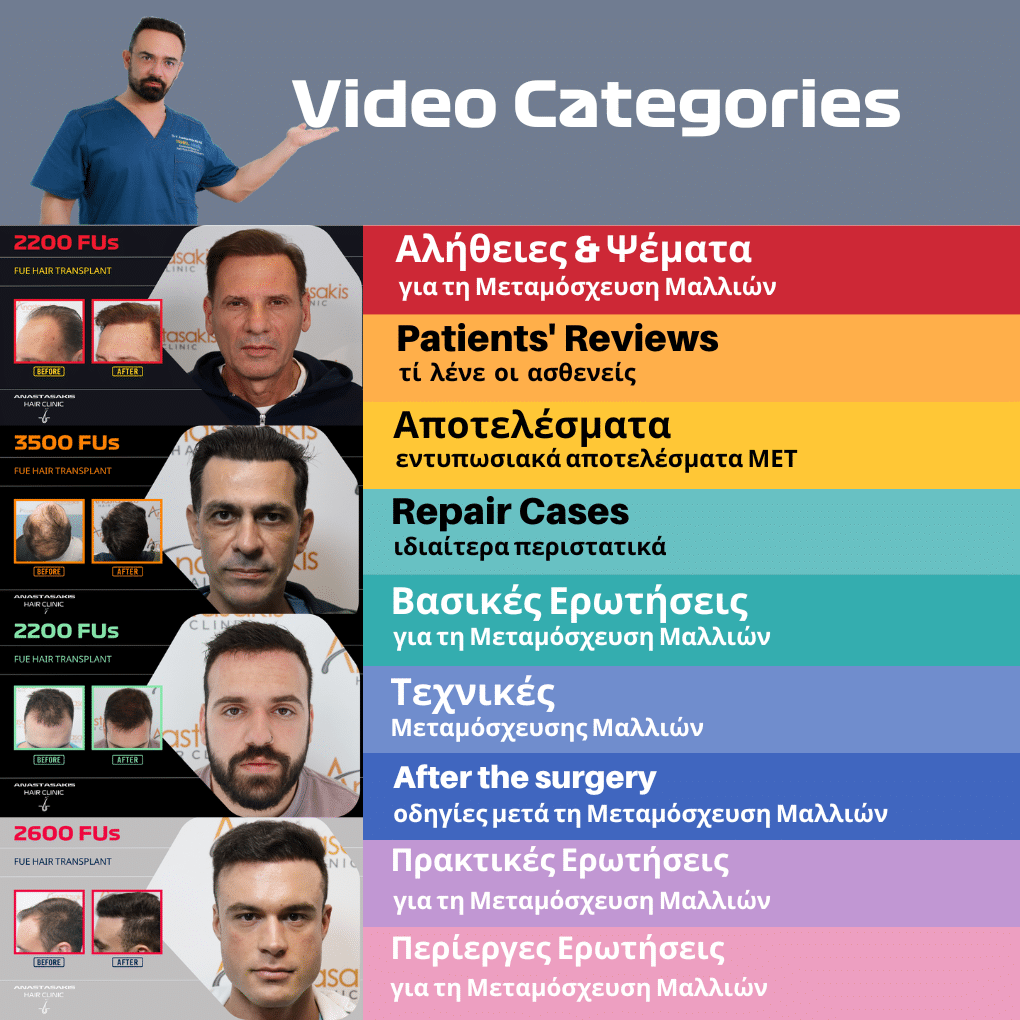 εντυπωσιακα αποτελ΄σματα της ANASTASAKIS HAIR CLiNIC