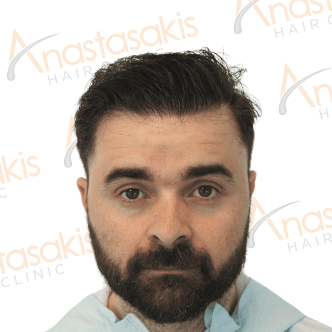 Anastasakis Hair Clinic