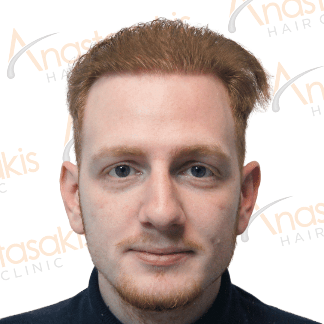 Anastasakis Hair Clinic