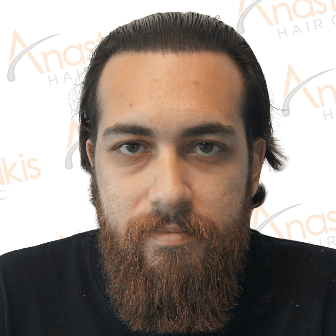 Anastasakis Hair Clinic