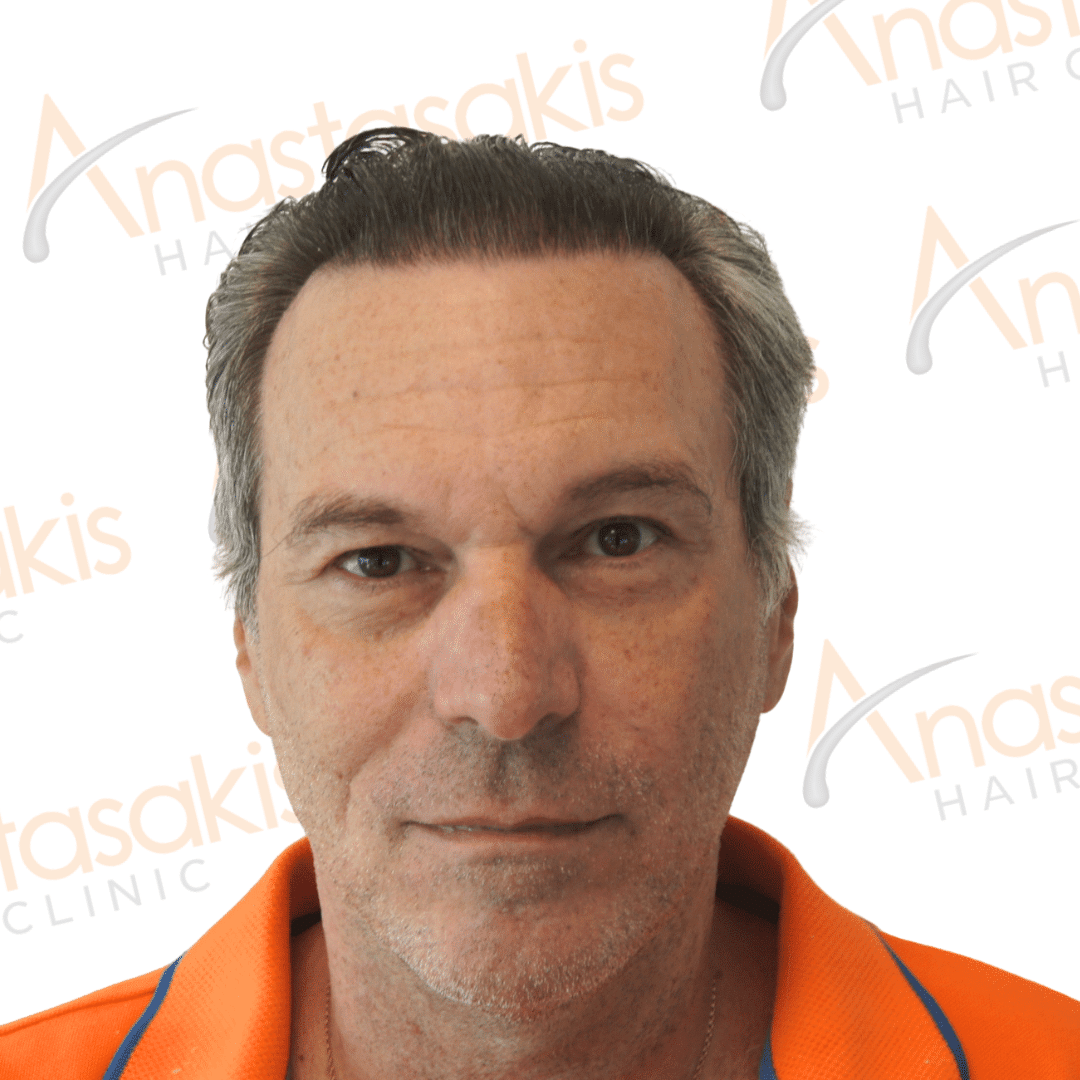 Anastasakis Hair Clinic