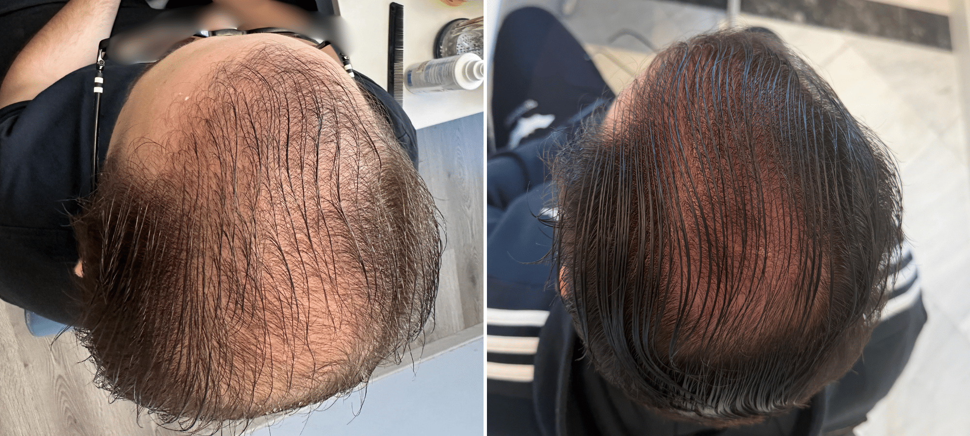 Dr. Anastasakis Hair Clinic