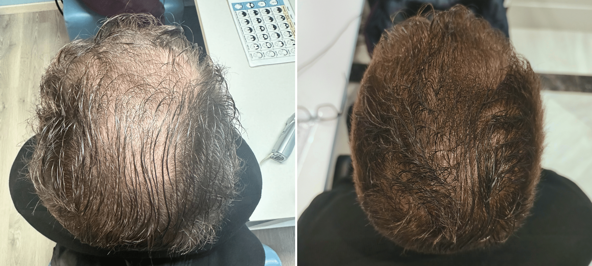 Dr. Anastasakis Hair Clinic