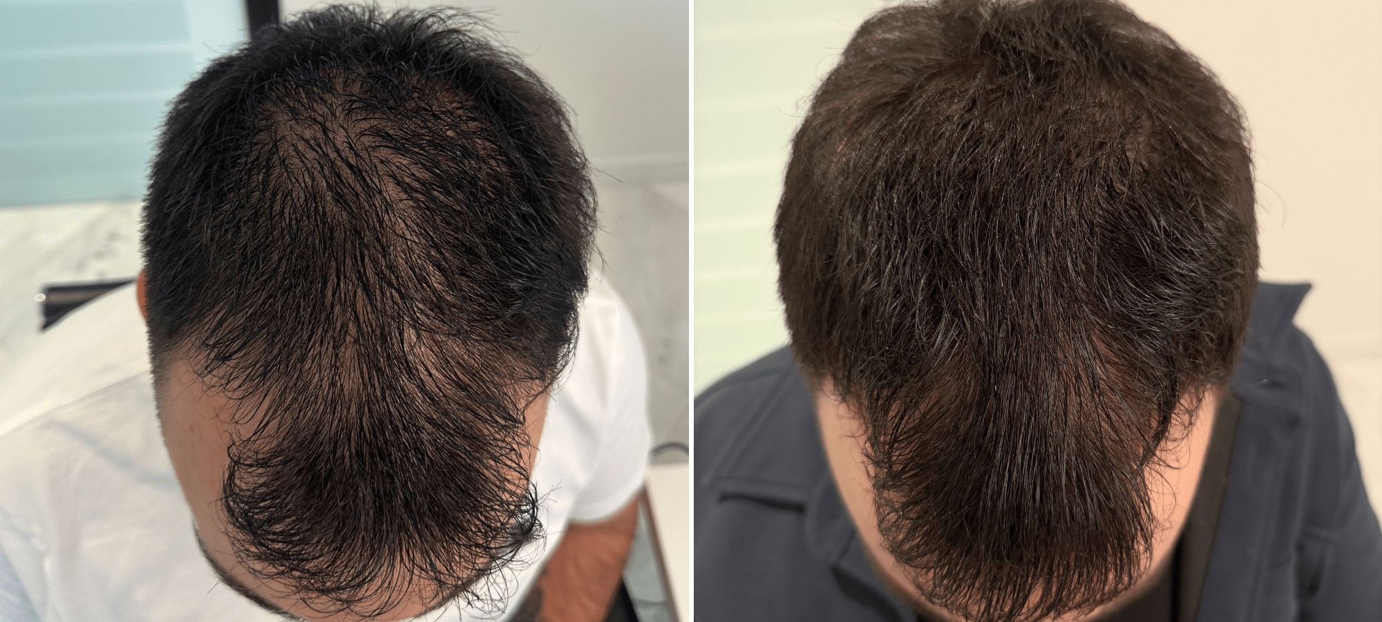 Dr. Anastasakis Hair Clinic