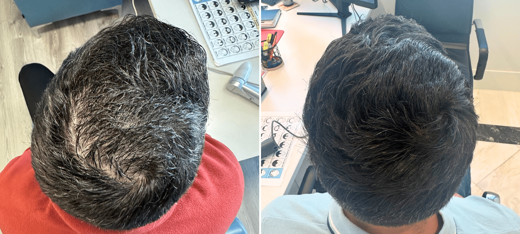 Dr. Anastasakis Hair Clinic
