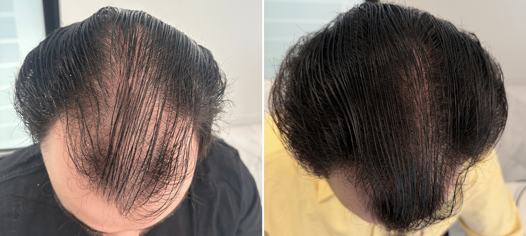 Dr. Anastasakis Hair Clinic