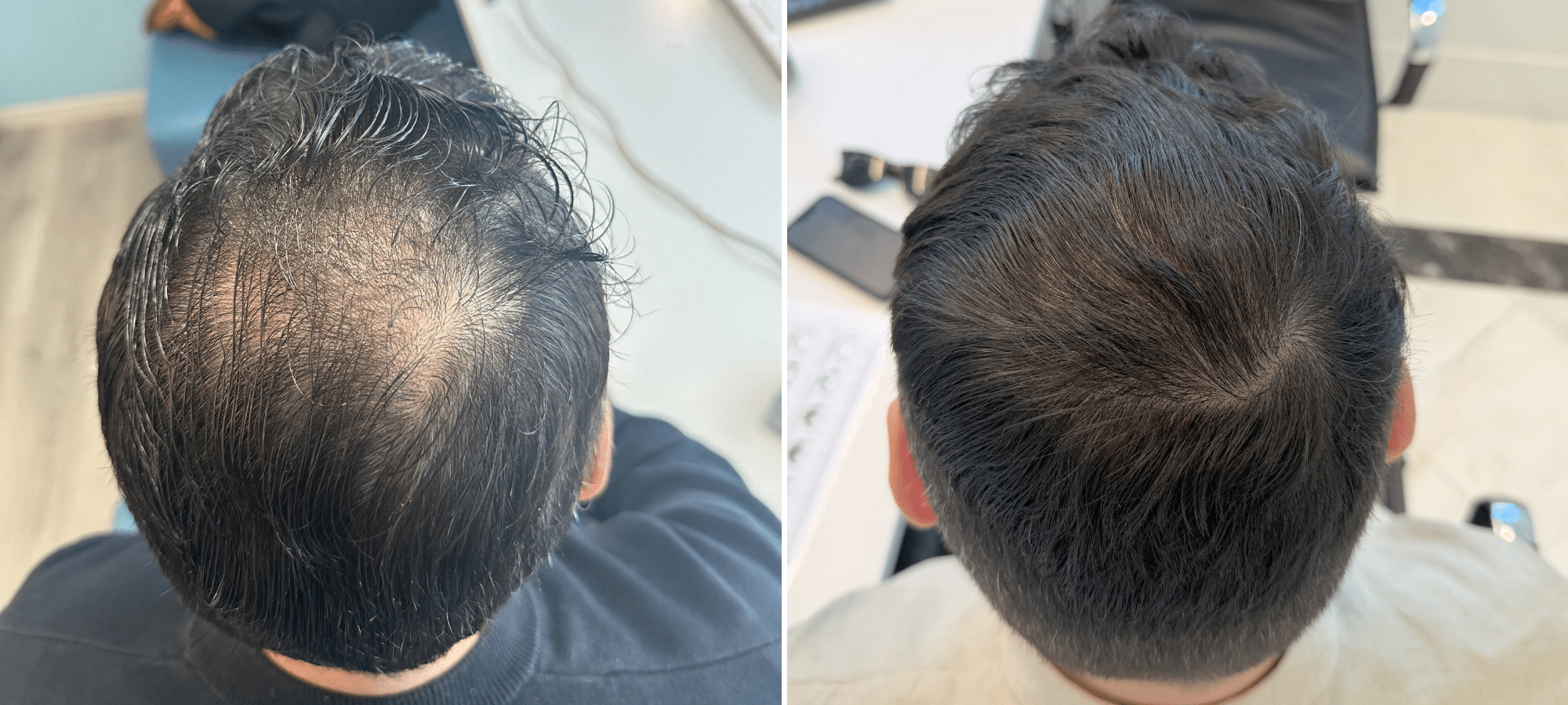 Dr. Anastasakis Hair Clinic