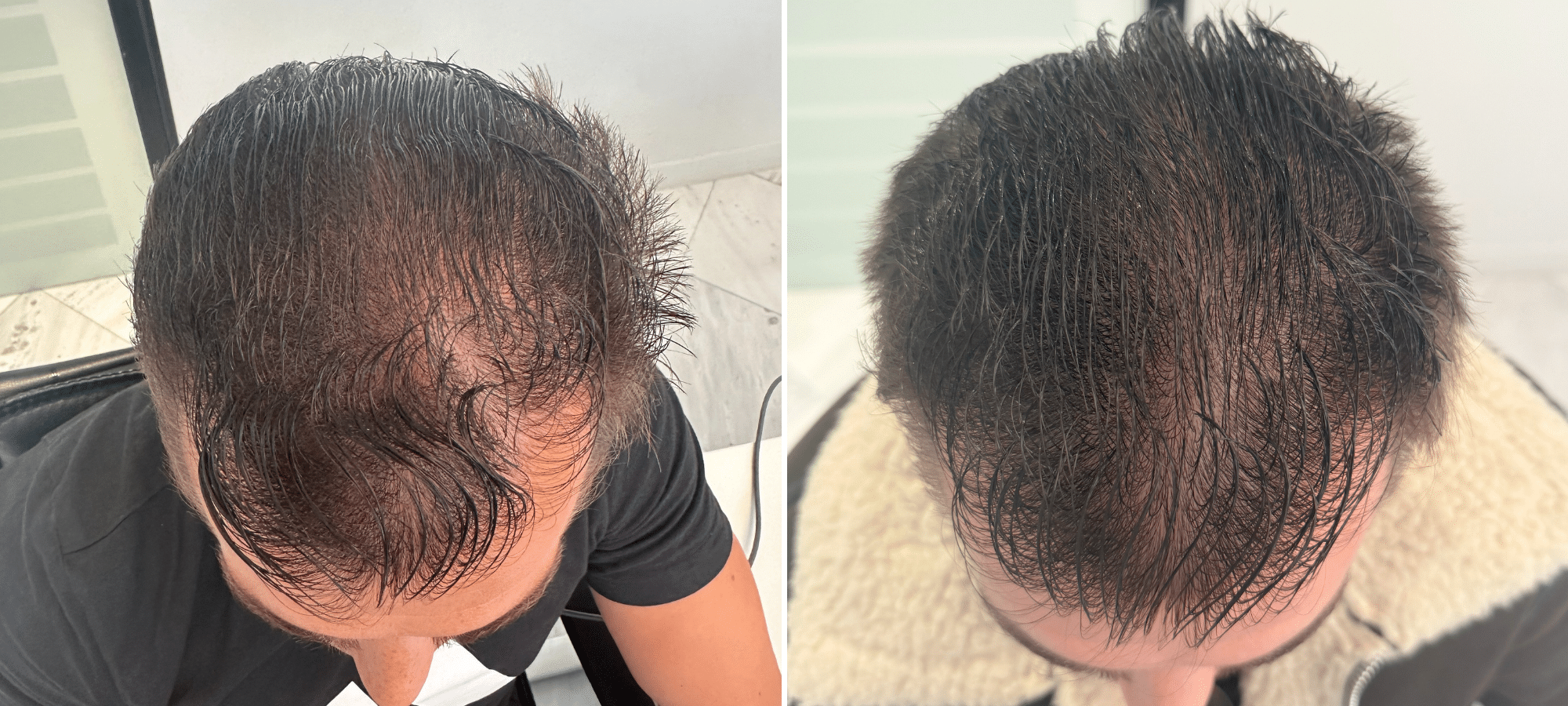 Dr. Anastasakis Hair Clinic