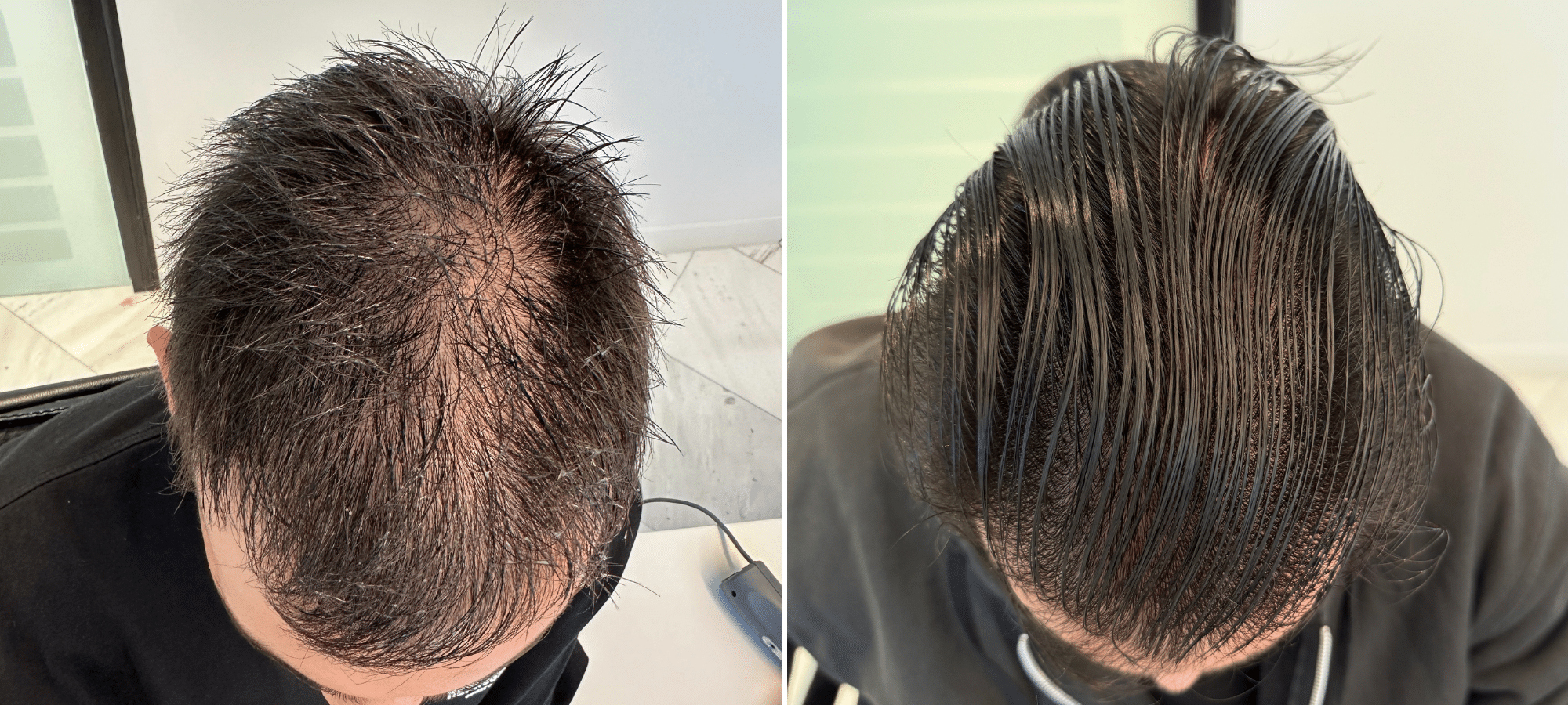 Dr. Anastasakis Hair Clinic