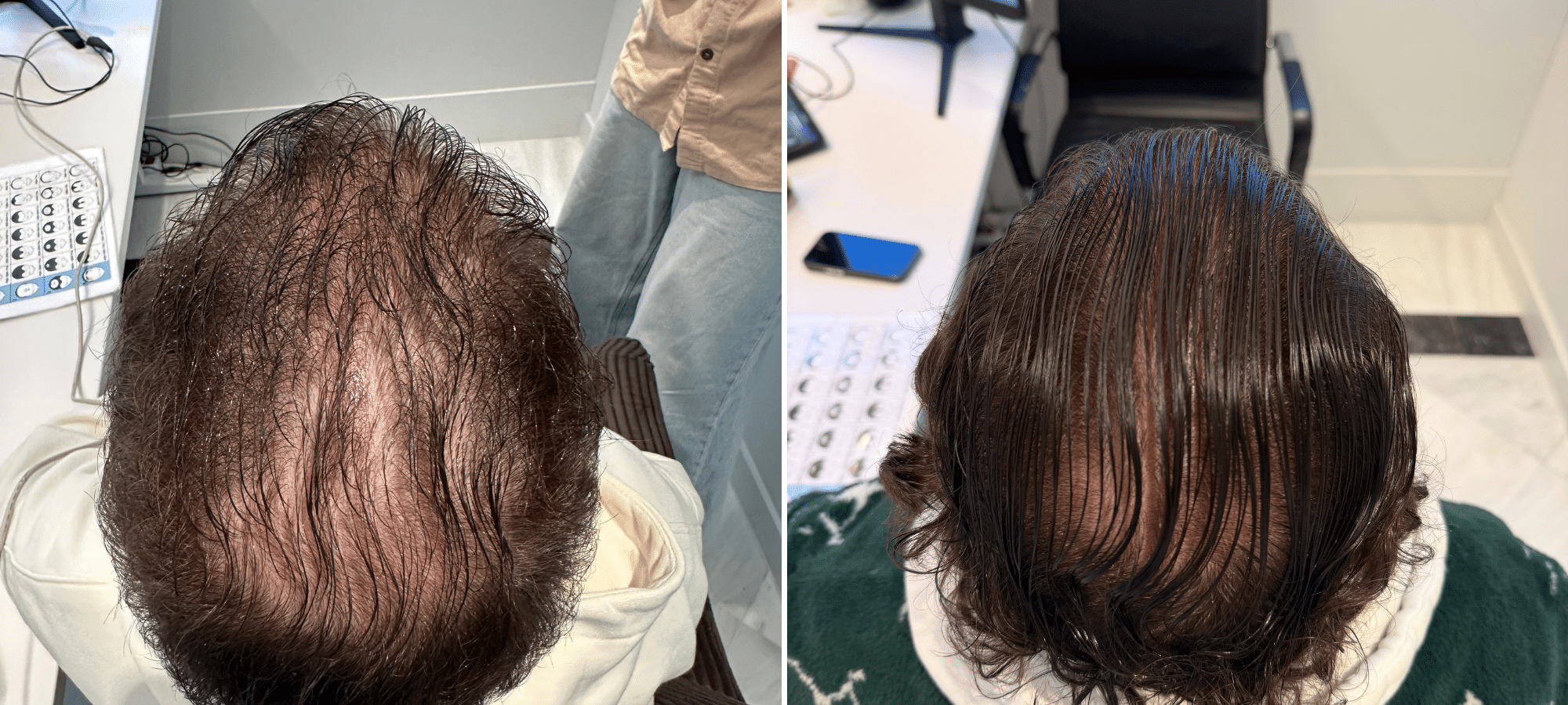 Dr. Anastasakis Hair Clinic
