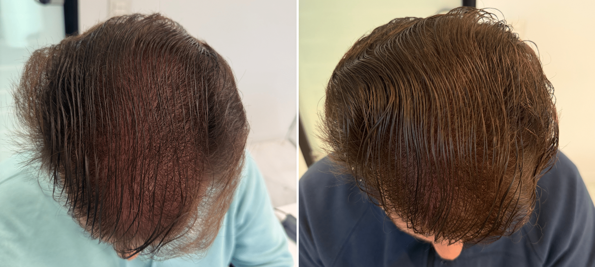 Dr. Anastasakis Hair Clinic