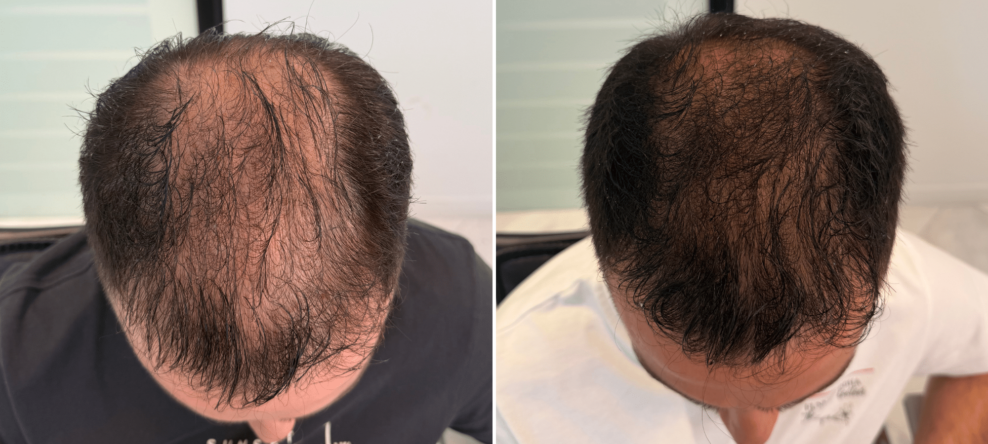 Dr. Anastasakis Hair Clinic