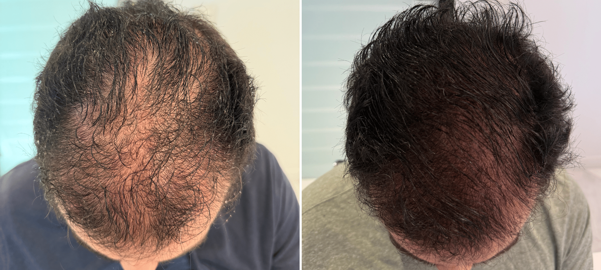 Dr. Anastasakis Hair Clinic