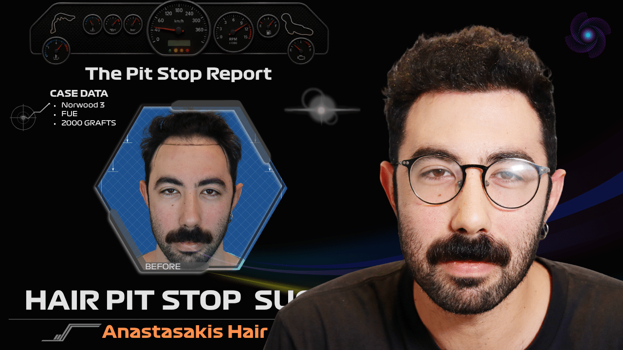 Anastasakis Hair Clinic
